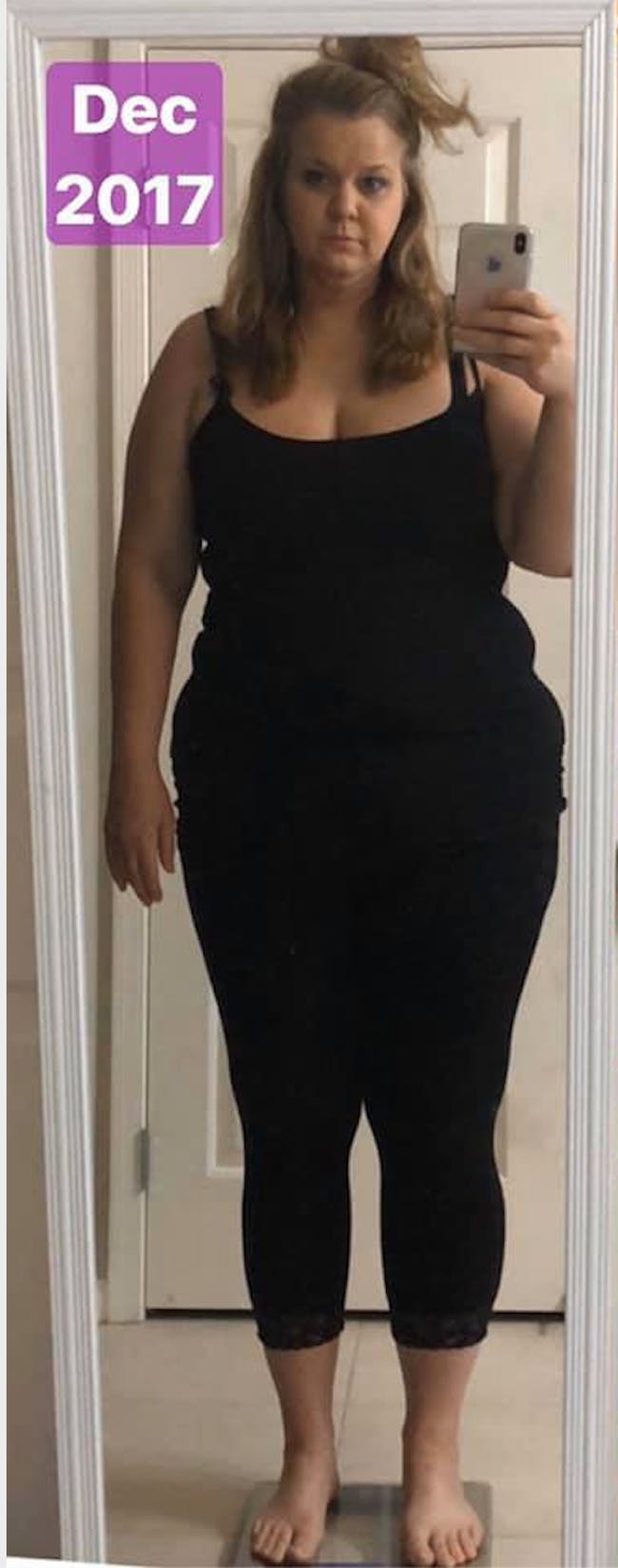 Kelly's patient journey before