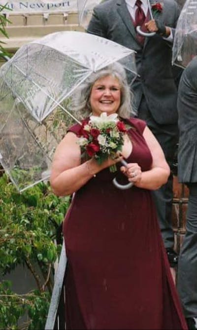 Patients 40-59 Years Old Before & After Gallery - Patient 14494466 - Image 1