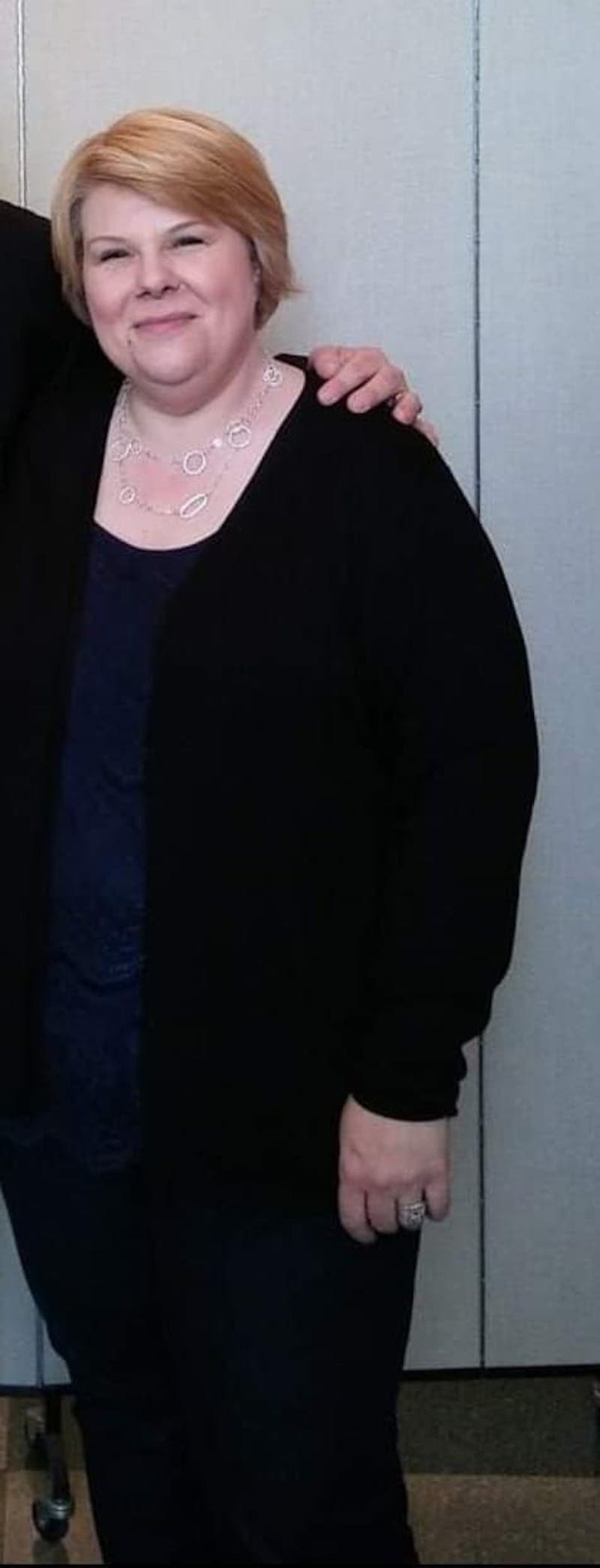 Patients 40-59 Years Old Before & After Gallery - Patient 14494467 - Image 1