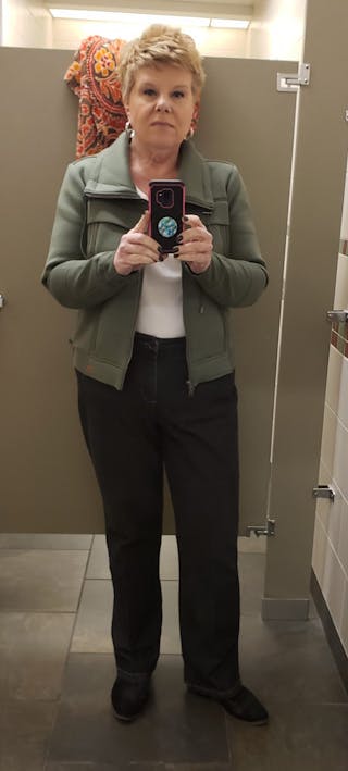 Patients 40-59 Years Old Before & After Gallery - Patient 14494467 - Image 2