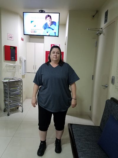 Patients 40-59 Years Old Before & After Gallery - Patient 14494469 - Image 1