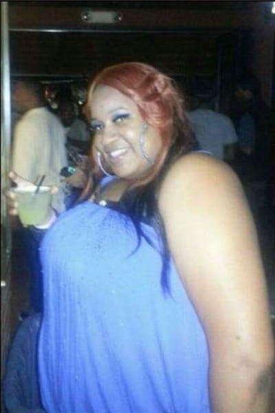 Patients 40-59 Years Old Before & After Gallery - Patient 14494471 - Image 1