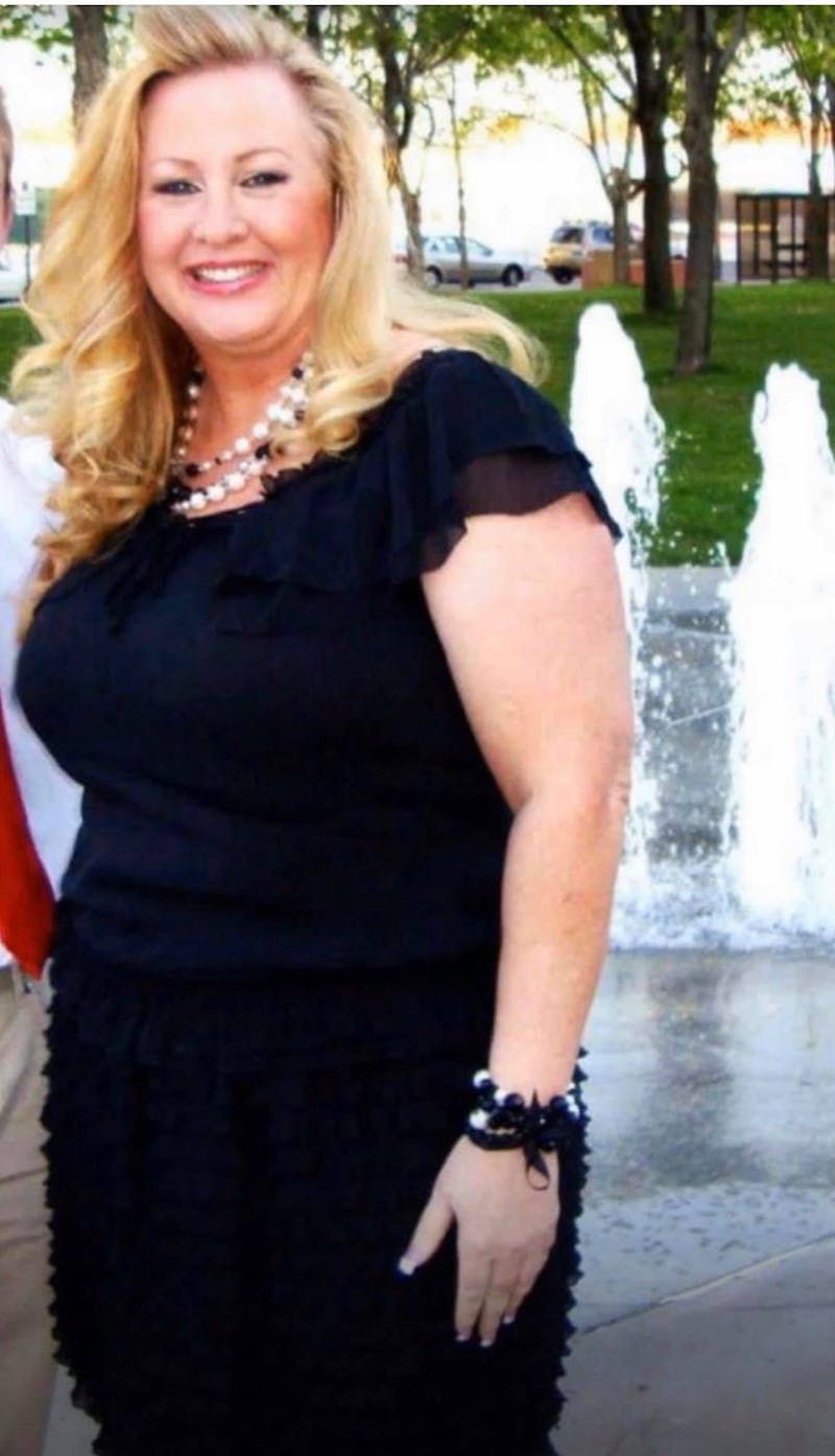 Patients 40-59 Years Old Before & After Gallery - Patient 14494472 - Image 1