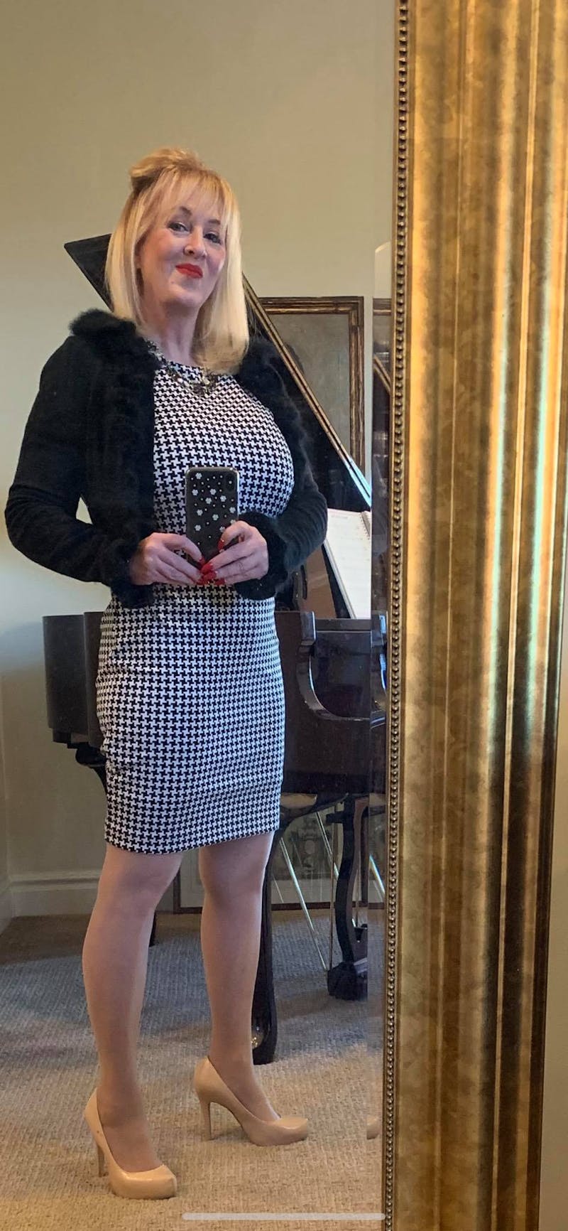 Patients 40-59 Years Old Before & After Gallery - Patient 14494472 - Image 2