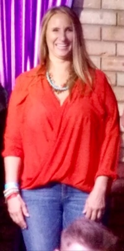 Patients 40-59 Years Old Before & After Gallery - Patient 14494473 - Image 1