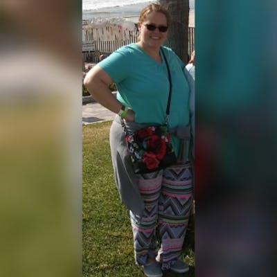 Patients 40-59 Years Old Before & After Gallery - Patient 14494475 - Image 1