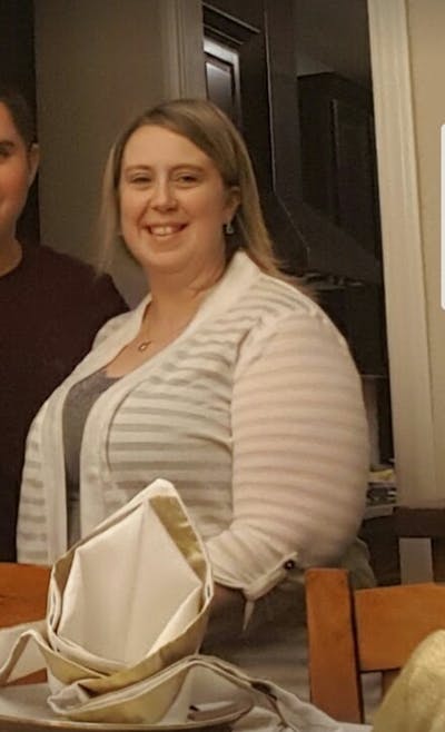 Patients 40-59 Years Old Before & After Gallery - Patient 14494481 - Image 1