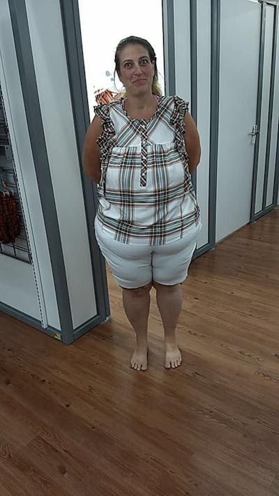 Patients 40-59 Years Old Before & After Gallery - Patient 14494485 - Image 2