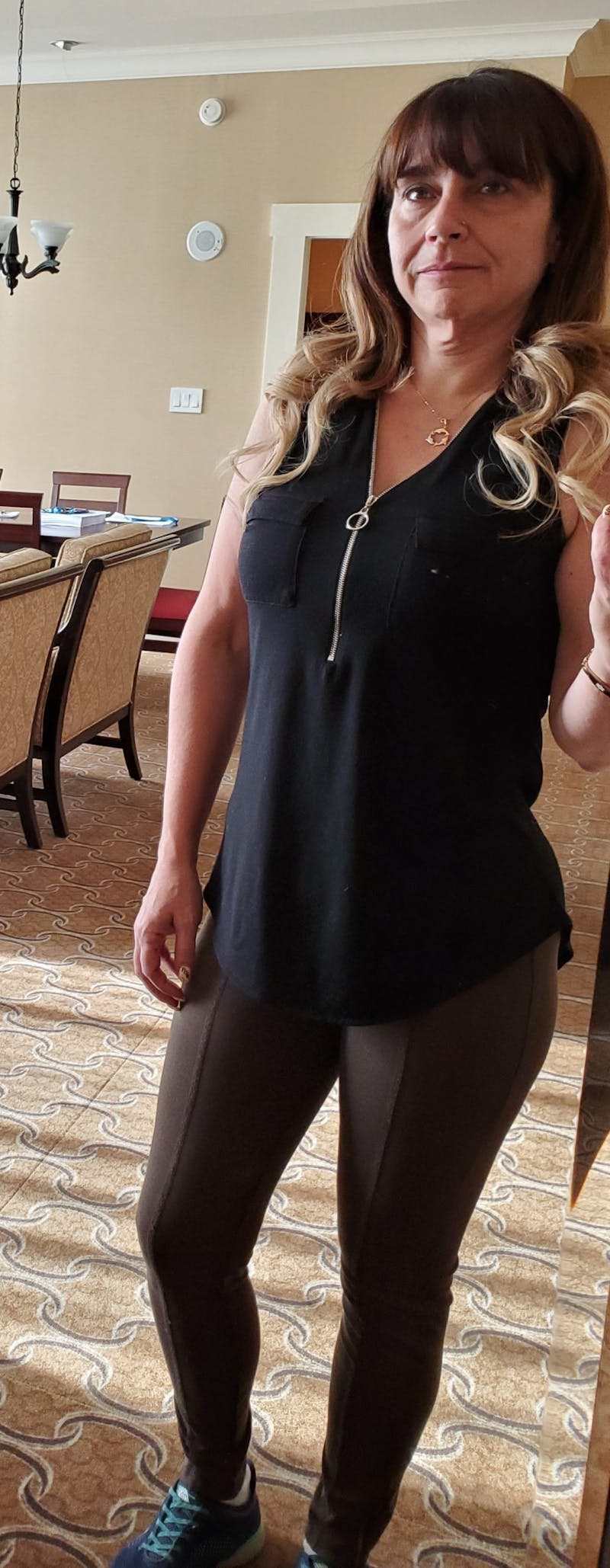 Patients 40-59 Years Old Before & After Gallery - Patient 14494486 - Image 2