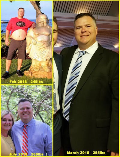 Patients 40-59 Years Old Before & After Gallery - Patient 14494487 - Image 1