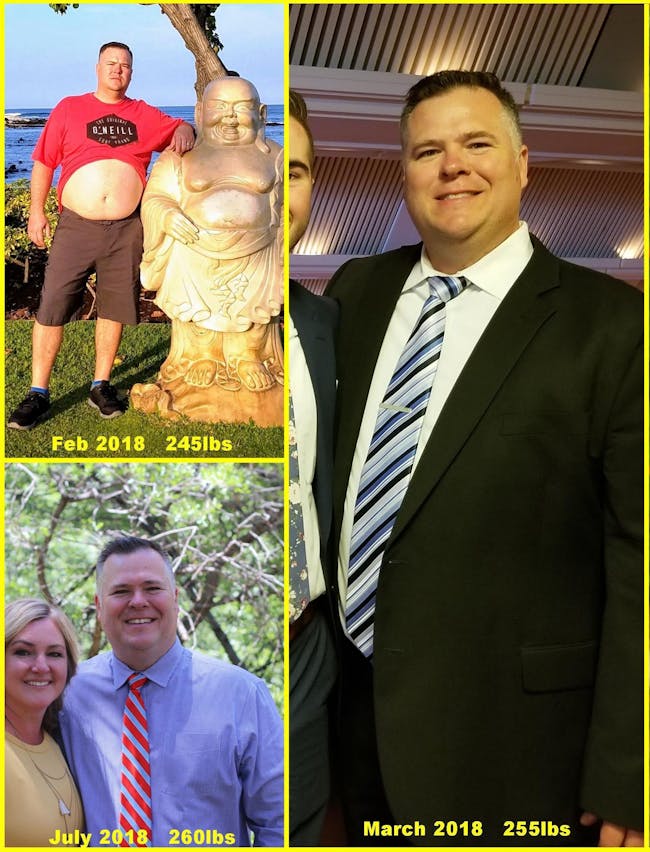 Todd's patient journey before