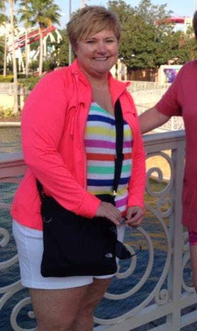 Patients 40-59 Years Old Before & After Gallery - Patient 14494491 - Image 1