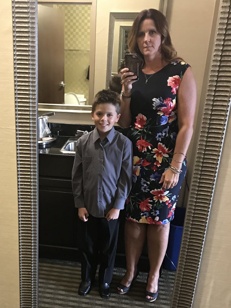 Patients 40-59 Years Old Before & After Gallery - Patient 14494493 - Image 2