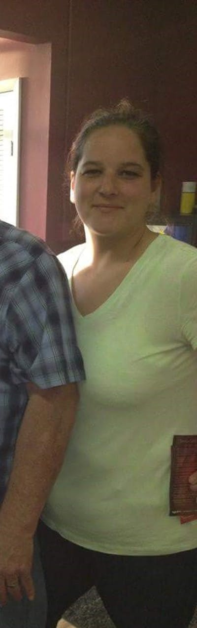 Patients 40-59 Years Old Before & After Gallery - Patient 14494494 - Image 1