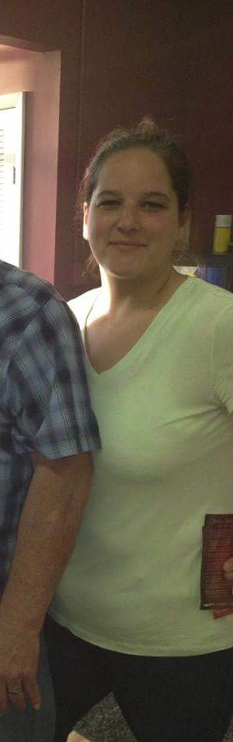 Patients 40-59 Years Old Before & After Gallery - Patient 14494494 - Image 1