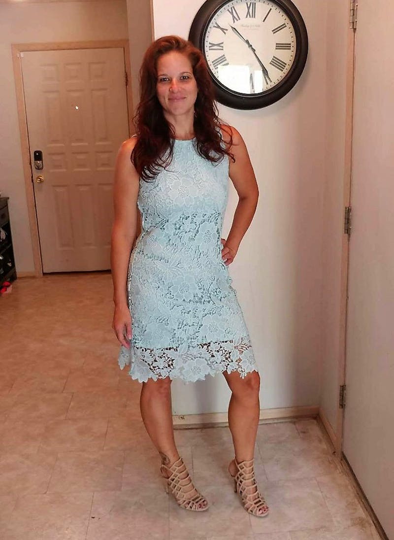 Patients 40-59 Years Old Before & After Gallery - Patient 14494494 - Image 2