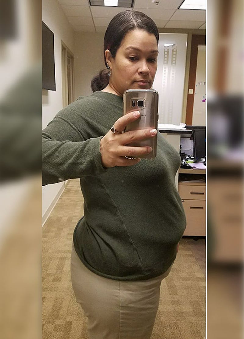 Patients 40-59 Years Old Before & After Gallery - Patient 14494500 - Image 1