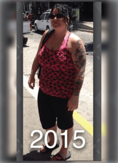 Patients 40-59 Years Old Before & After Gallery - Patient 14494503 - Image 1