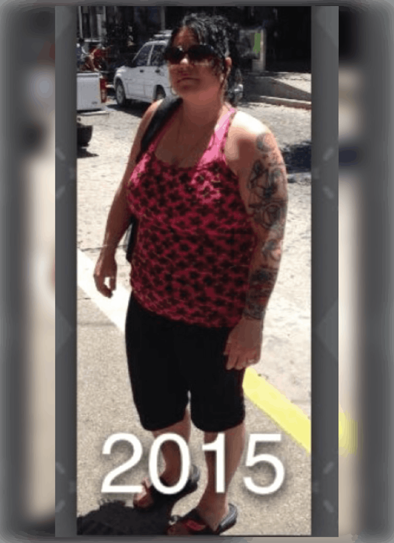 Patients 40-59 Years Old Before & After Gallery - Patient 14494503 - Image 1