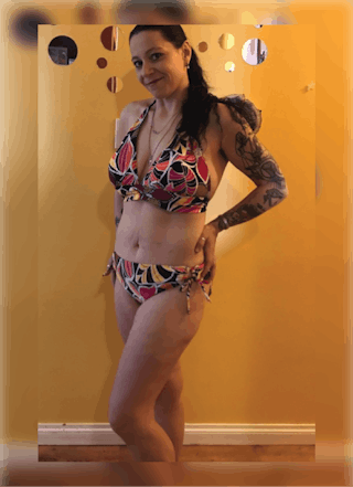 Patients 40-59 Years Old Before & After Gallery - Patient 14494503 - Image 2