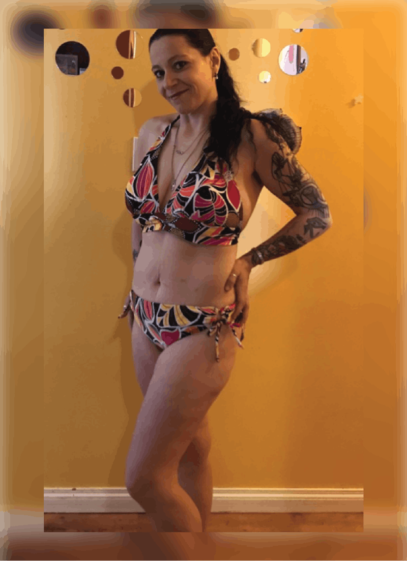 Patients 40-59 Years Old Before & After Gallery - Patient 14494503 - Image 2