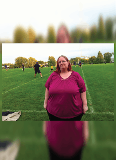 Patients 40-59 Years Old Before & After Gallery - Patient 14494505 - Image 1