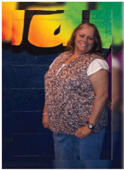 Patients 40-59 Years Old Before & After Gallery - Patient 14494506 - Image 1