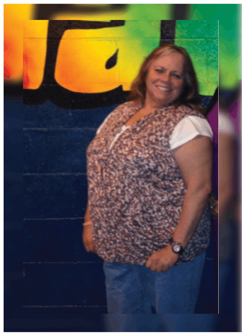 Patients 40-59 Years Old Before & After Gallery - Patient 14494506 - Image 1