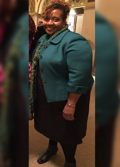 Patients 40-59 Years Old Before & After Gallery - Patient 14494507 - Image 1