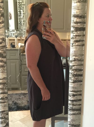 Patients 40-59 Years Old Before & After Gallery - Patient 14494510 - Image 1