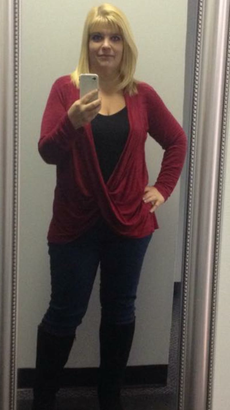 Patients 40-59 Years Old Before & After Gallery - Patient 14494511 - Image 2