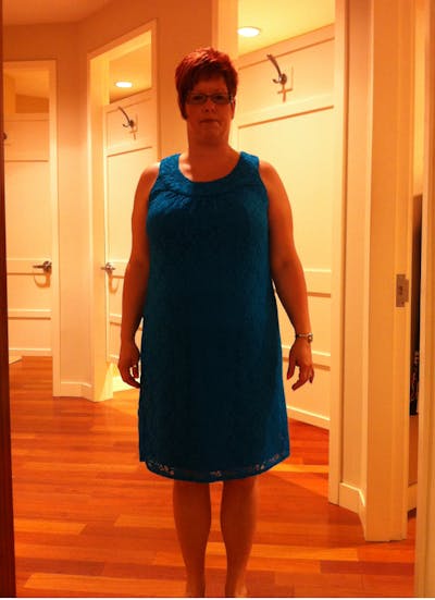 Patients 40-59 Years Old Before & After Gallery - Patient 14494512 - Image 1