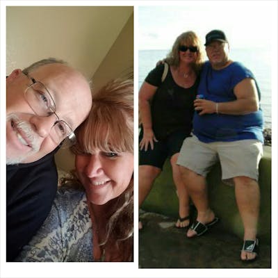 Patients 40-59 Years Old Before & After Gallery - Patient 14494515 - Image 1