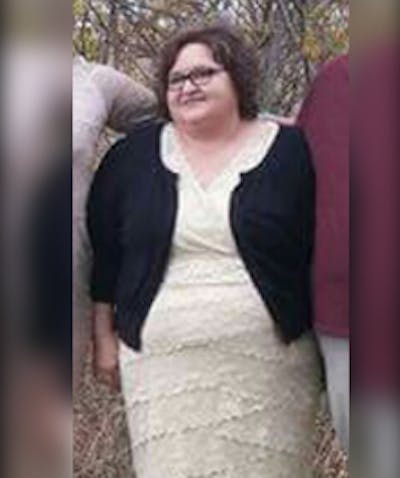 Patients 40-59 Years Old Before & After Gallery - Patient 14494517 - Image 1