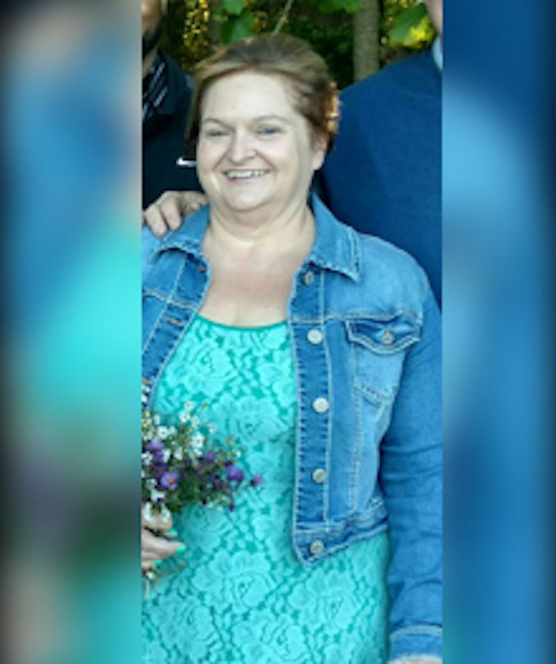 Patients 40-59 Years Old Before & After Gallery - Patient 14494517 - Image 2