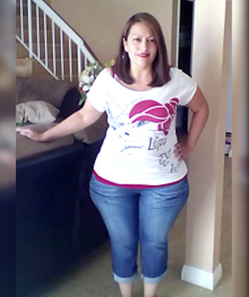 Patients 40-59 Years Old Before & After Gallery - Patient 14494518 - Image 1