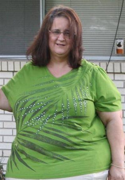 Patients 40-59 Years Old Before & After Gallery - Patient 14494522 - Image 1