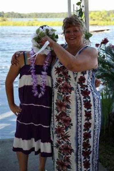 Patients 40-59 Years Old Before & After Gallery - Patient 14494526 - Image 1