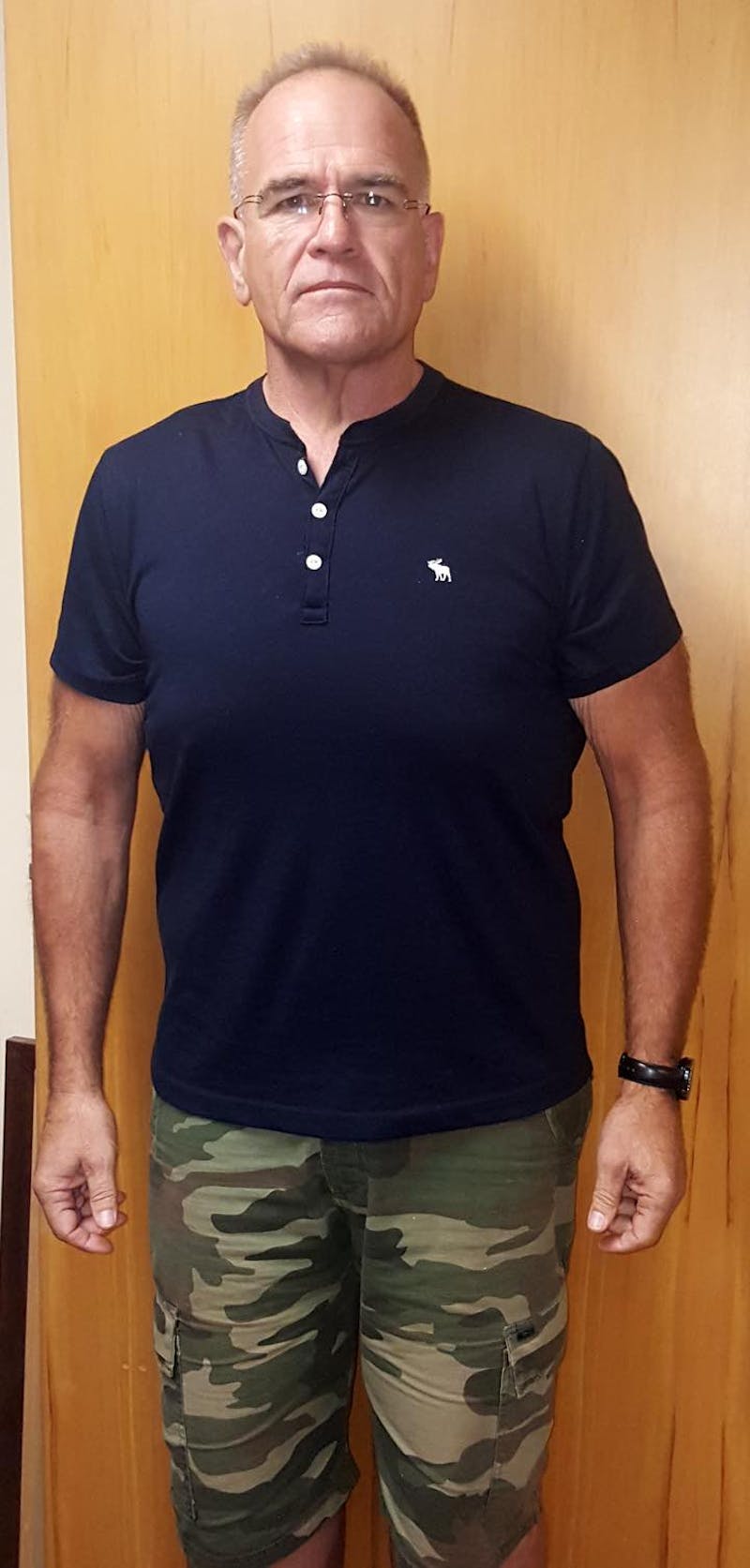 Patients 40-59 Years Old Before & After Gallery - Patient 14494527 - Image 2