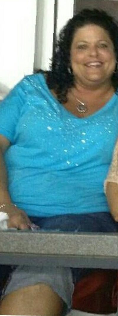 Patients 40-59 Years Old Before & After Gallery - Patient 14494529 - Image 1