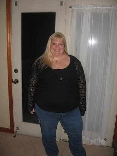 Patients 40-59 Years Old Before & After Gallery - Patient 14494530 - Image 1