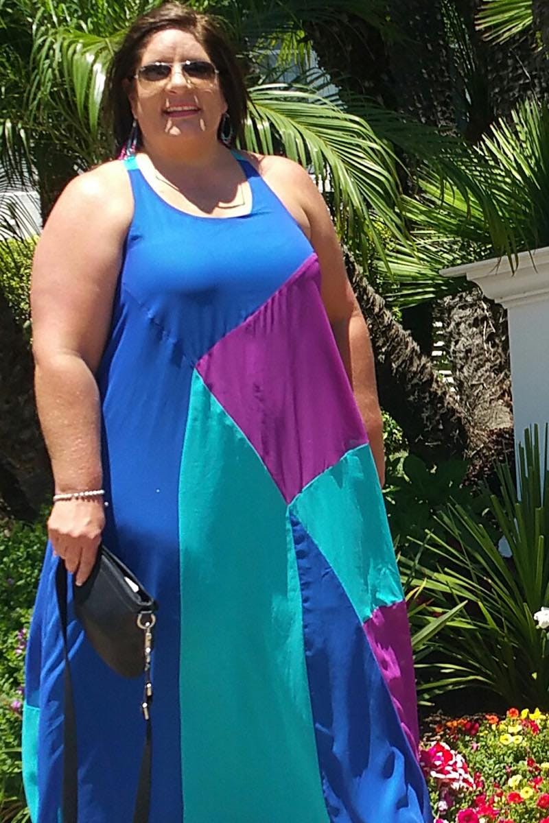 Patients 40-59 Years Old Before & After Gallery - Patient 14494534 - Image 1