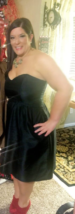 Patients 40-59 Years Old Before & After Gallery - Patient 14494534 - Image 2