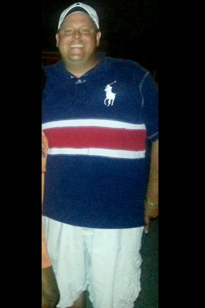 Patients 40-59 Years Old Before & After Gallery - Patient 14494535 - Image 1