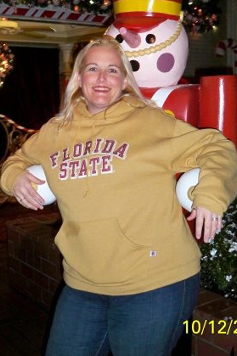 Patients 40-59 Years Old Before & After Gallery - Patient 14494538 - Image 1