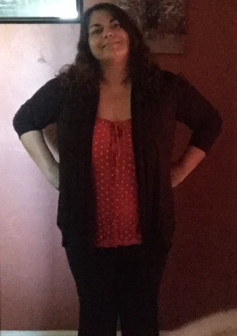 Patients 40-59 Years Old Before & After Gallery - Patient 14494539 - Image 1