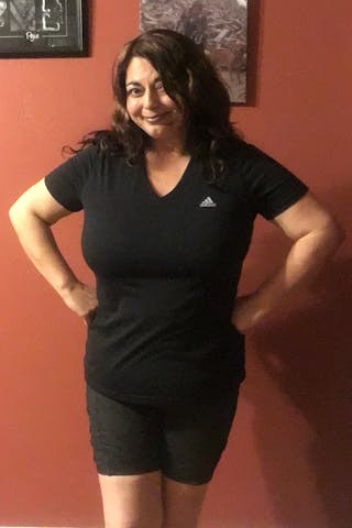 Patients 40-59 Years Old Before & After Gallery - Patient 14494539 - Image 2