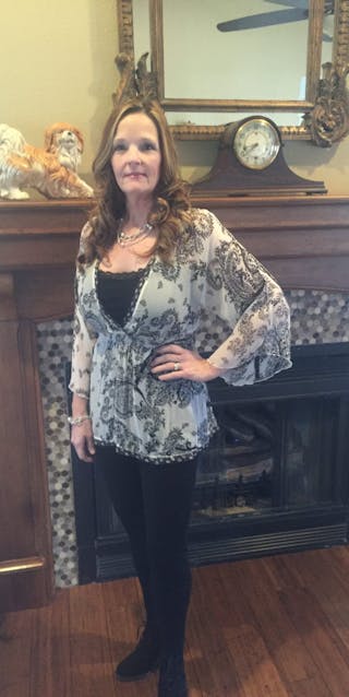 Patients 40-59 Years Old Before & After Gallery - Patient 14494540 - Image 2