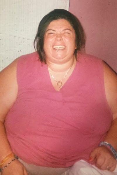 Patients 40-59 Years Old Before & After Gallery - Patient 14494541 - Image 1