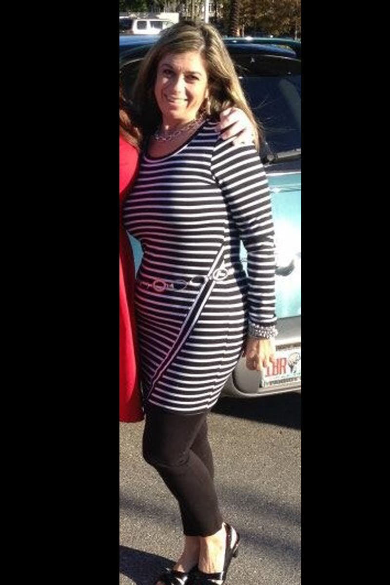 Patients 40-59 Years Old Before & After Gallery - Patient 14494541 - Image 2